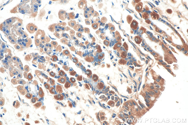 NRG1 Antibody in Immunohistochemistry (Paraffin) (IHC (P))