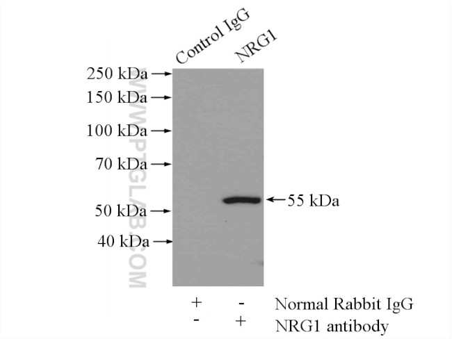 NRG1 Antibody in Immunoprecipitation (IP)