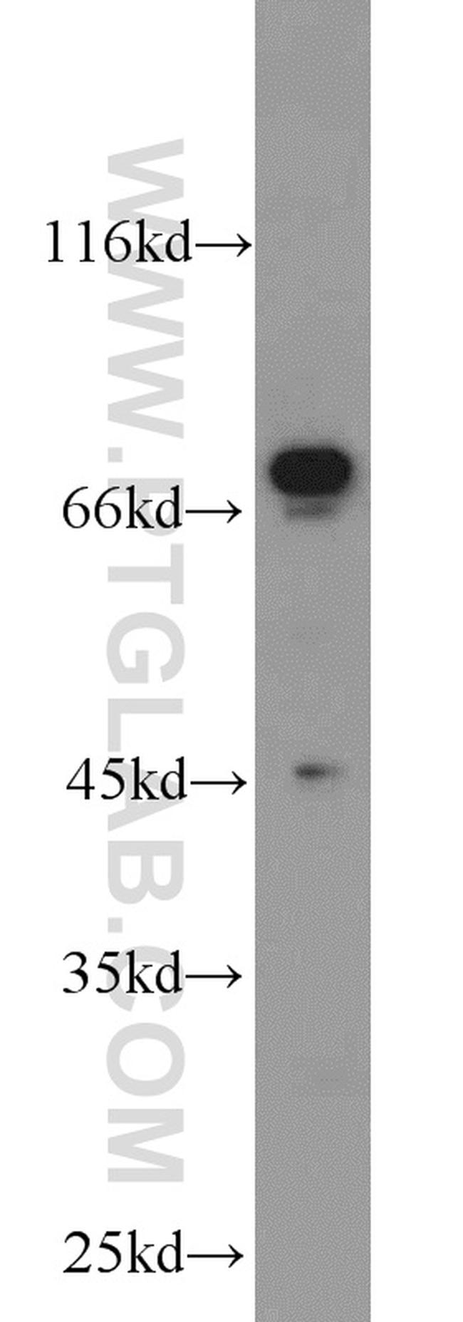 NRG1 Antibody in Western Blot (WB)