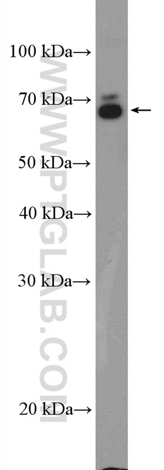 NRG1 Antibody in Western Blot (WB)