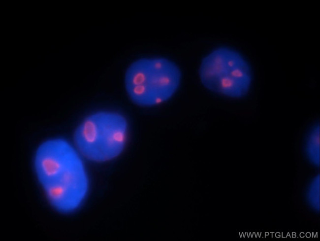 DDX21 Antibody in Immunocytochemistry (ICC/IF)