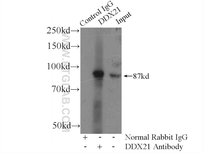 DDX21 Antibody in Immunoprecipitation (IP)