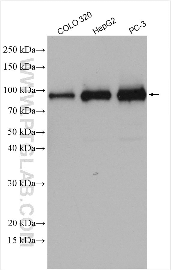 DDX21 Antibody in Western Blot (WB)