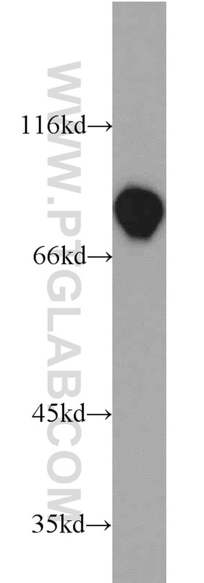 DDX21 Antibody in Western Blot (WB)