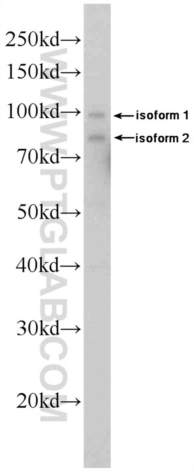 DDX21 Antibody in Western Blot (WB)