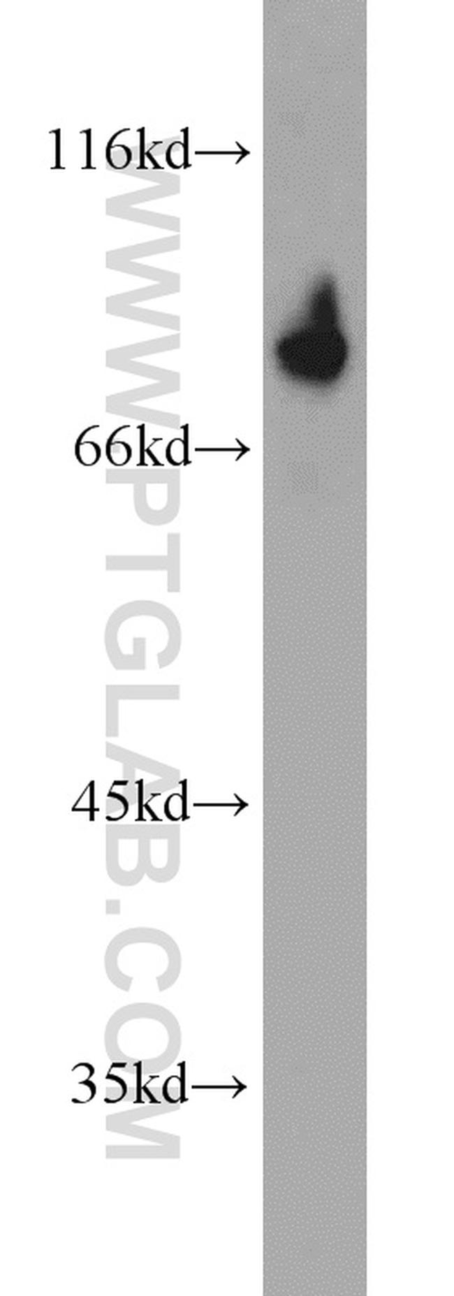 DDX21 Antibody in Western Blot (WB)