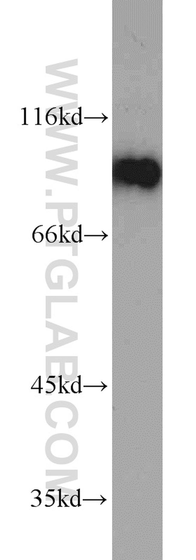 DDX21 Antibody in Western Blot (WB)