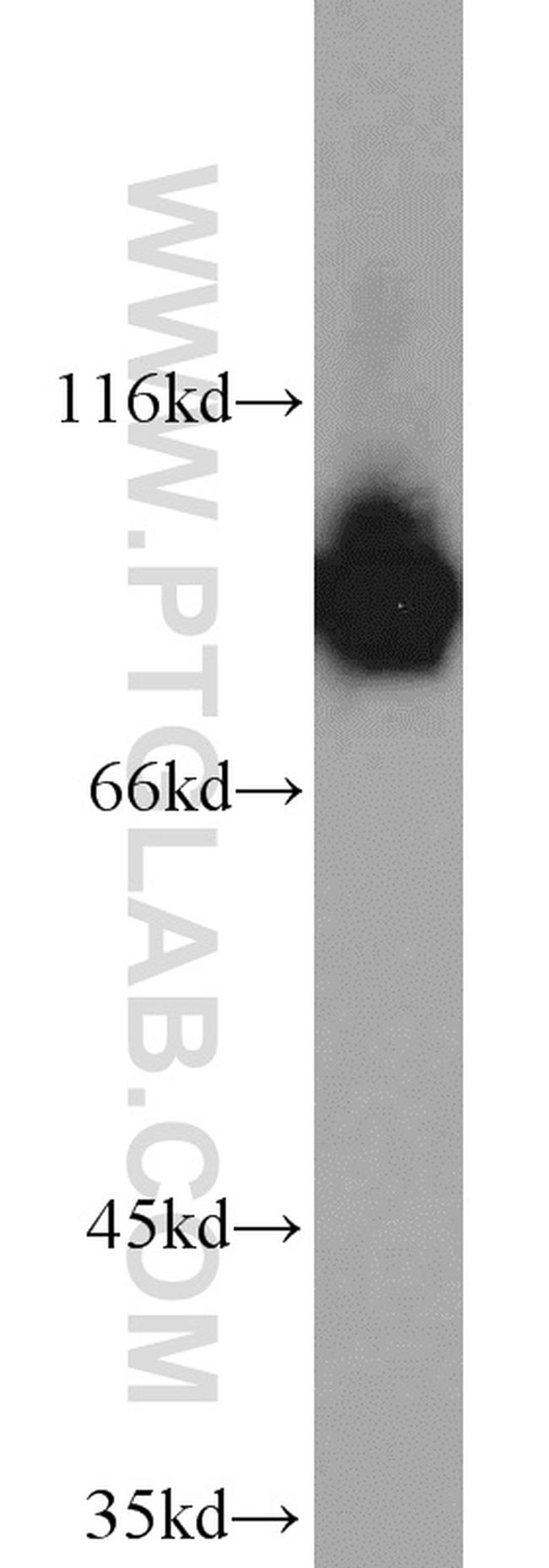 DDX21 Antibody in Western Blot (WB)