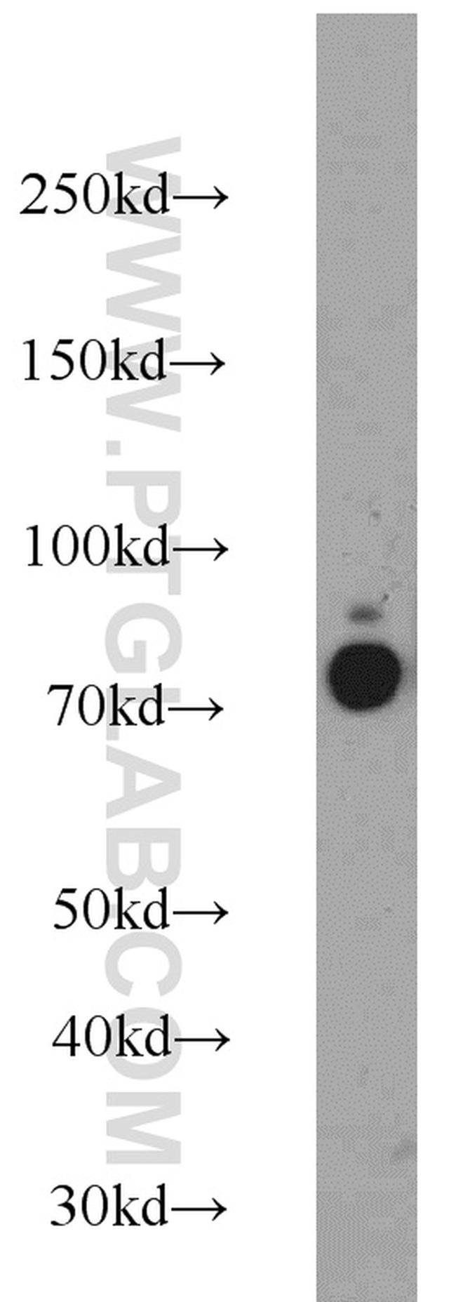 DDX21 Antibody in Western Blot (WB)