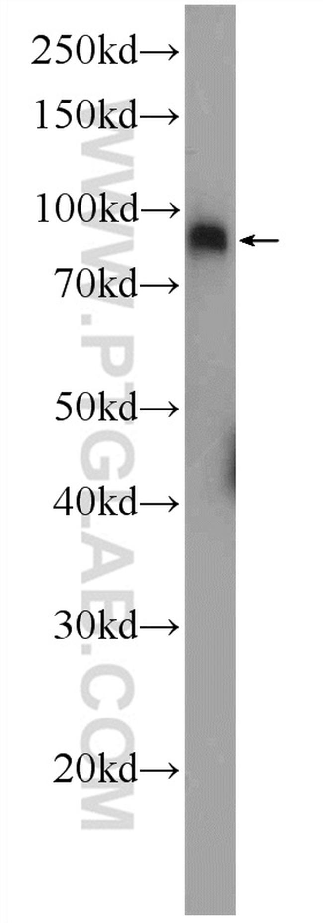 DDX21 Antibody in Western Blot (WB)