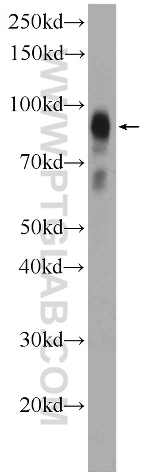 DDX21 Antibody in Western Blot (WB)