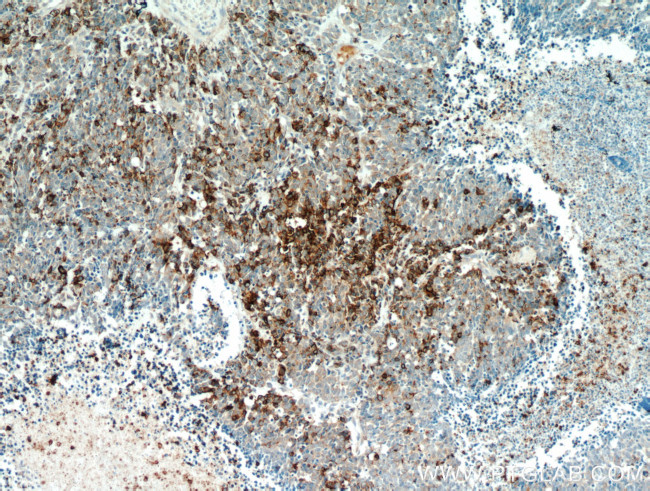 Chromogranin A Antibody in Immunohistochemistry (Paraffin) (IHC (P))