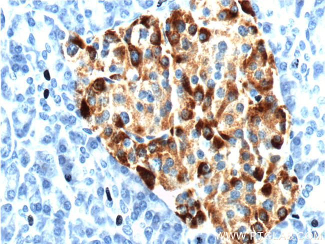 Chromogranin A Antibody in Immunohistochemistry (Paraffin) (IHC (P))