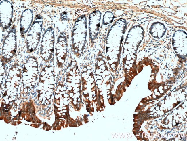 Chromogranin A Antibody in Immunohistochemistry (Paraffin) (IHC (P))