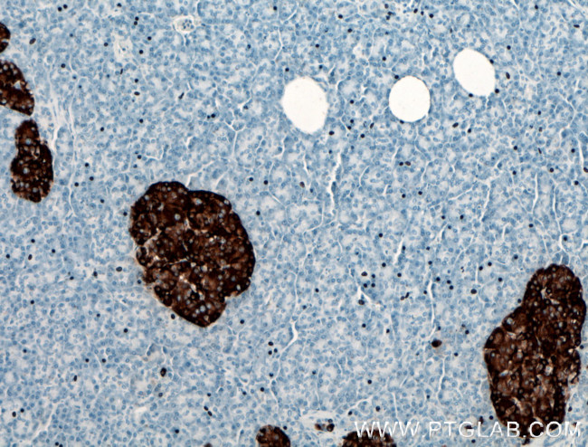 Chromogranin A Antibody in Immunohistochemistry (Paraffin) (IHC (P))