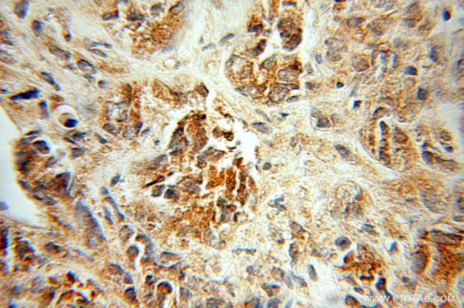 PDLIM5 Antibody in Immunohistochemistry (Paraffin) (IHC (P))