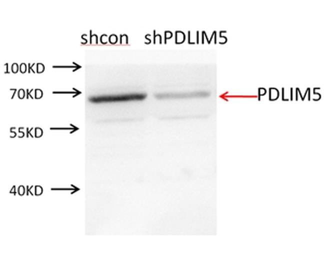 PDLIM5 Antibody in Western Blot (WB)