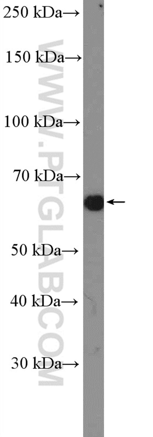 PDLIM5 Antibody in Western Blot (WB)