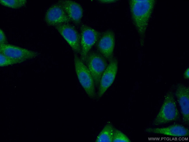 DAD1 Antibody in Immunocytochemistry (ICC/IF)