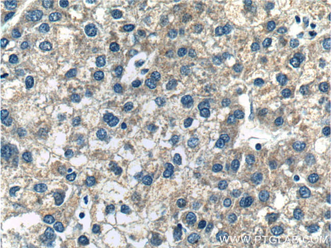 DAD1 Antibody in Immunohistochemistry (Paraffin) (IHC (P))