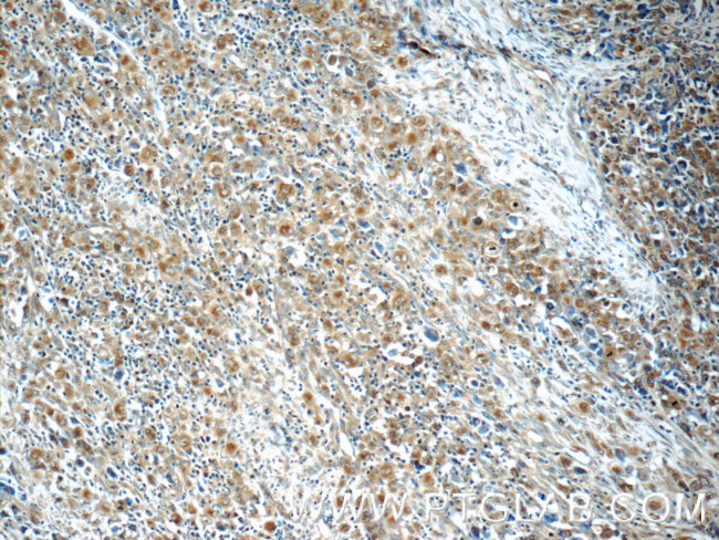 IL21R Antibody in Immunohistochemistry (Paraffin) (IHC (P))