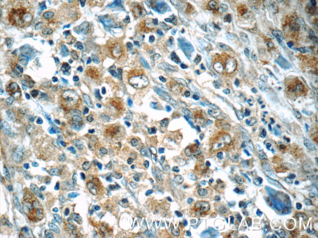 IL21R Antibody in Immunohistochemistry (Paraffin) (IHC (P))