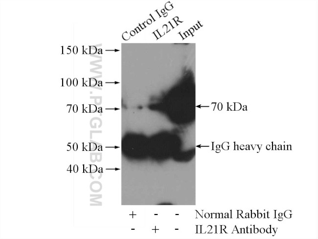 IL21R Antibody in Immunoprecipitation (IP)