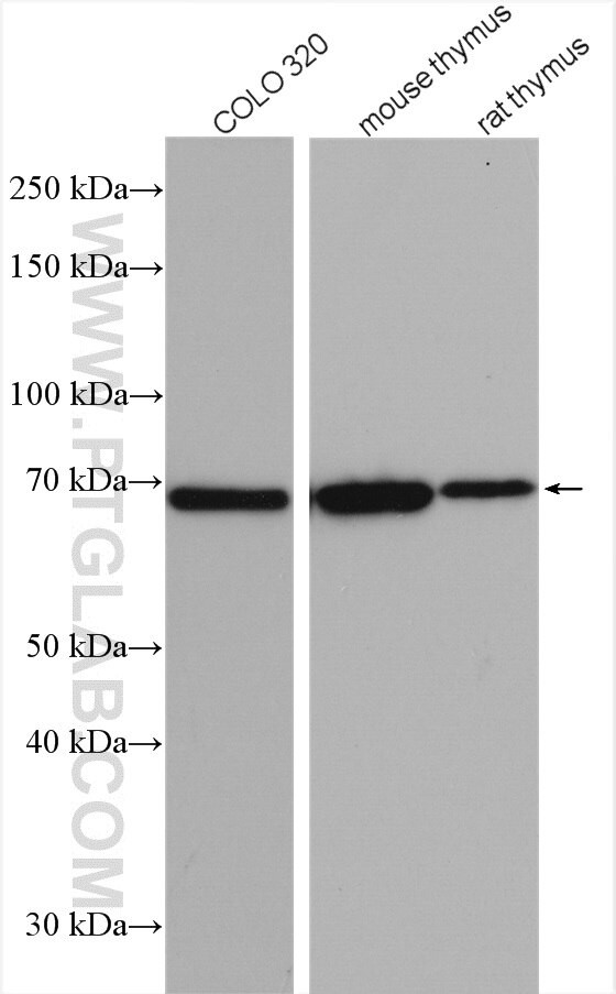 IL21R Antibody in Western Blot (WB)