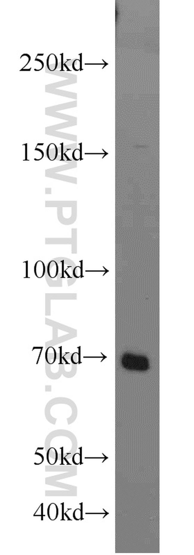 IL21R Antibody in Western Blot (WB)