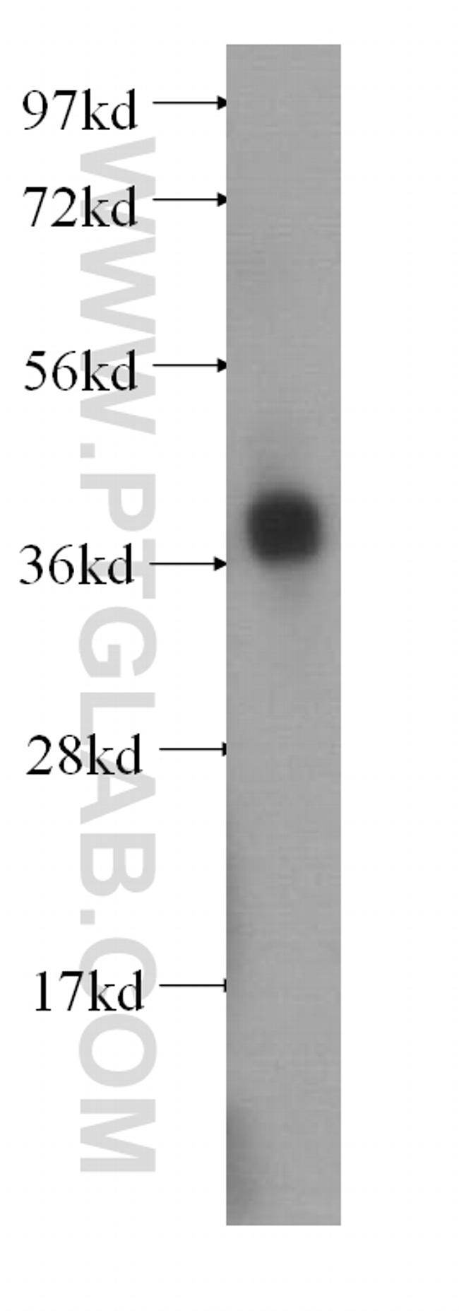 B4GALT7 Antibody in Western Blot (WB)