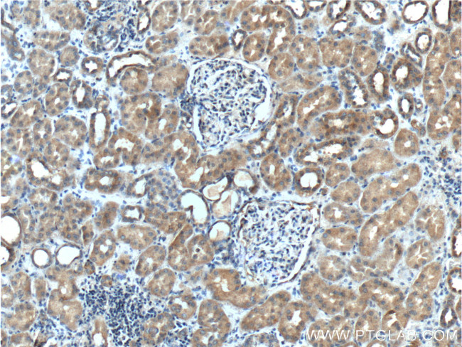 DDR1 Antibody in Immunohistochemistry (Paraffin) (IHC (P))