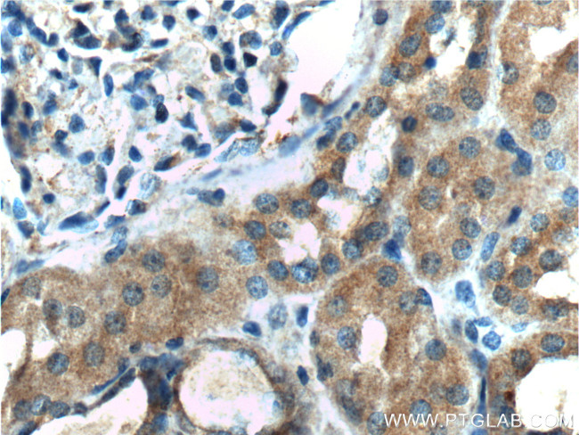 DDR1 Antibody in Immunohistochemistry (Paraffin) (IHC (P))