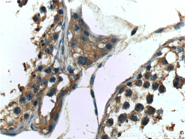 DDR1 Antibody in Immunohistochemistry (Paraffin) (IHC (P))