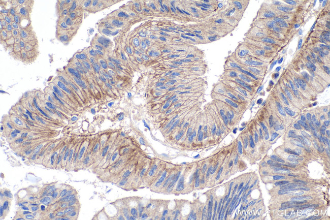 DDR1 Antibody in Immunohistochemistry (Paraffin) (IHC (P))