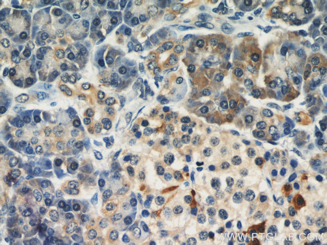 Dermatopontin Antibody in Immunohistochemistry (Paraffin) (IHC (P))