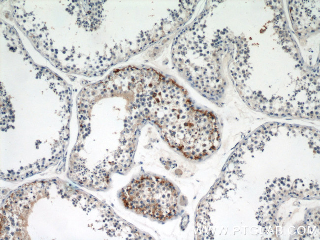 Dermatopontin Antibody in Immunohistochemistry (Paraffin) (IHC (P))