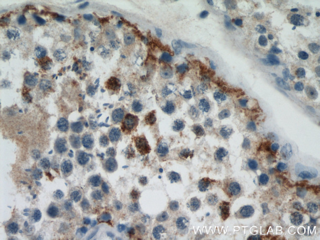 Dermatopontin Antibody in Immunohistochemistry (Paraffin) (IHC (P))