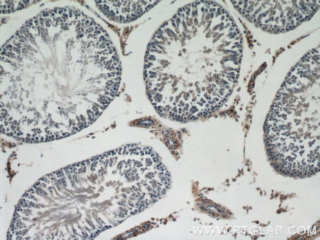 Dermatopontin Antibody in Immunohistochemistry (Paraffin) (IHC (P))