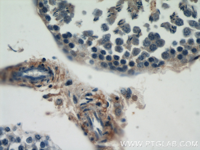 Dermatopontin Antibody in Immunohistochemistry (Paraffin) (IHC (P))