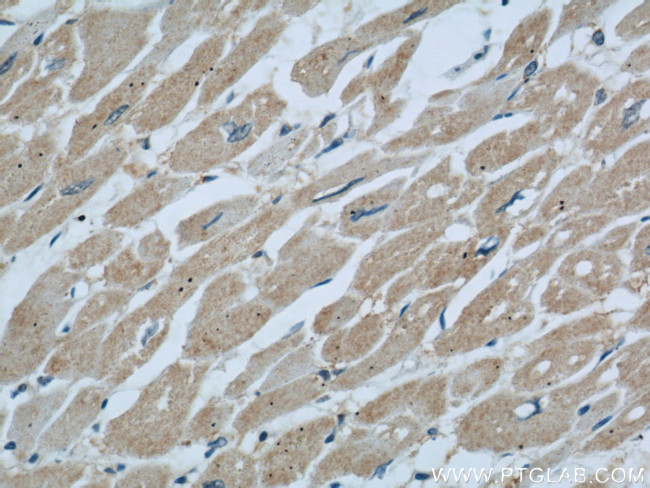 Dermatopontin Antibody in Immunohistochemistry (Paraffin) (IHC (P))