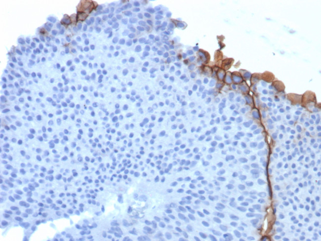 Uroplakin 3B (UPK3B) (Marker of Mesothelial and Umbrella Cells) Antibody in Immunohistochemistry (Paraffin) (IHC (P))