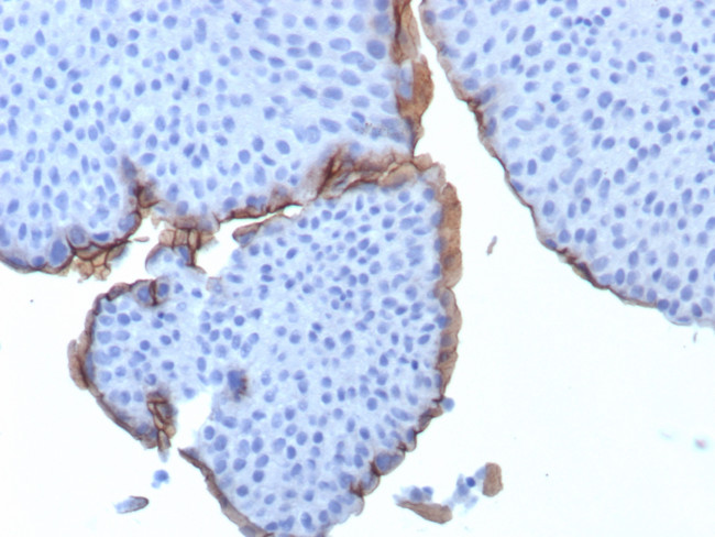 Uroplakin 3B (UPK3B) (Marker of Mesothelial and Umbrella Cells) Antibody in Immunohistochemistry (Paraffin) (IHC (P))