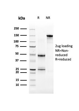 Uroplakin 3B (UPK3B) (Marker of Mesothelial and Umbrella Cells) Antibody in SDS-PAGE (SDS-PAGE)