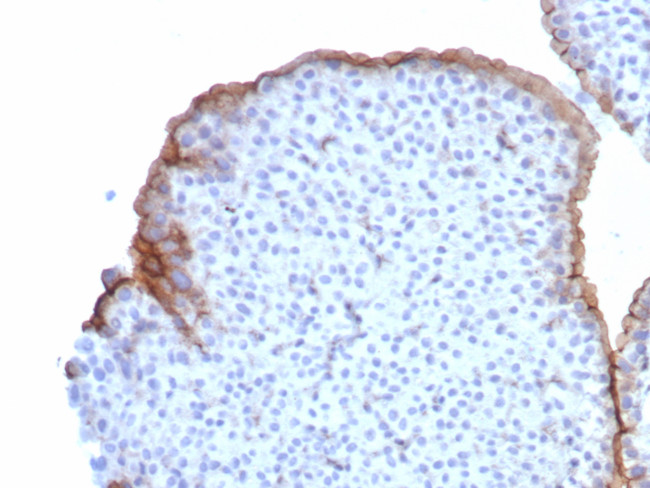 Uroplakin 3B (UPK3B) (Marker of Mesothelial and Umbrella Cells) Antibody in Immunohistochemistry (Paraffin) (IHC (P))