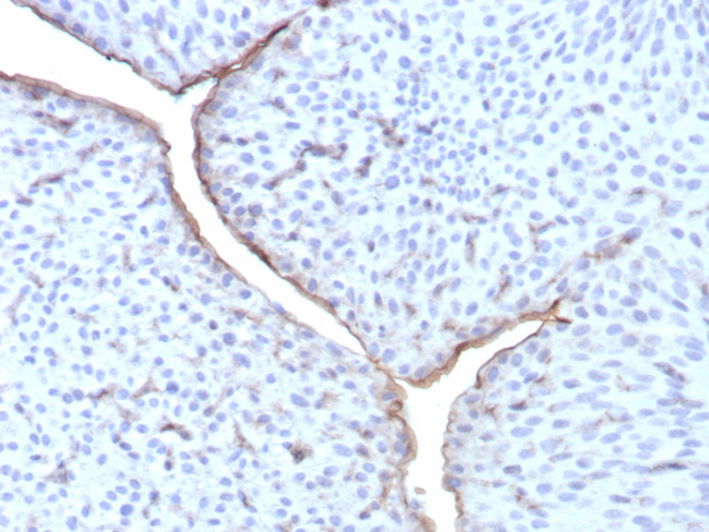 Uroplakin 3B (UPK3B) (Marker of Mesothelial and Umbrella Cells) Antibody in Immunohistochemistry (Paraffin) (IHC (P))