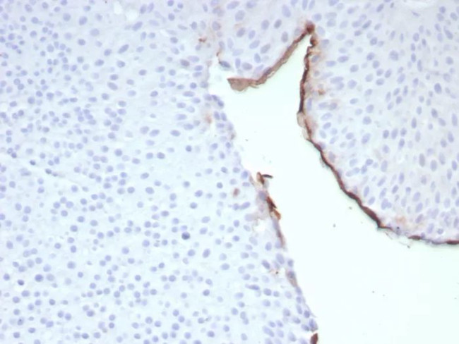 Uroplakin 3B (UPK3B) (Marker of Mesothelial and Umbrella Cells) Antibody in Immunohistochemistry (Paraffin) (IHC (P))