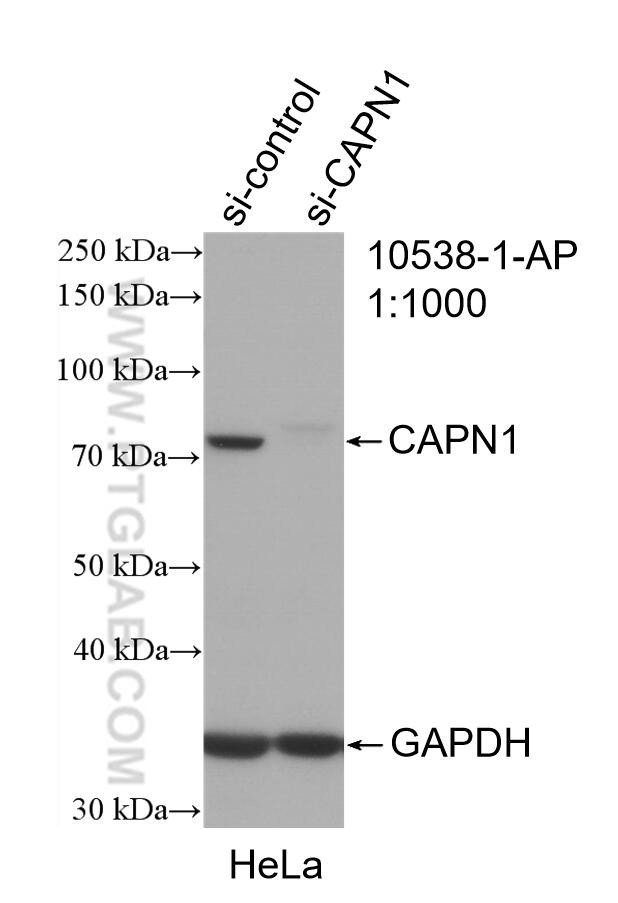 Calpain 1 Antibody in Western Blot (WB)