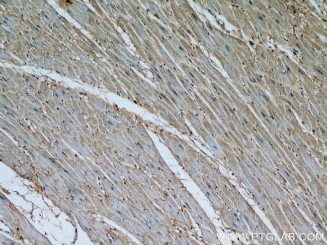 Calpain 1 Antibody in Immunohistochemistry (Paraffin) (IHC (P))