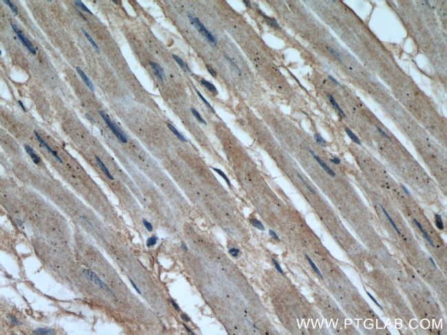 Calpain 1 Antibody in Immunohistochemistry (Paraffin) (IHC (P))