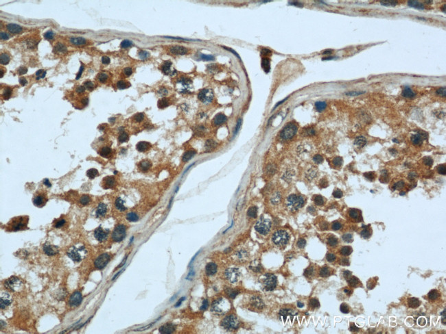 Calpain 1 Antibody in Immunohistochemistry (Paraffin) (IHC (P))